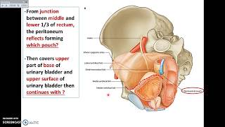 Overview of Pelvis 7  Pelvic Peritoneum  Dr Ahmed Farid [upl. by Asemaj]