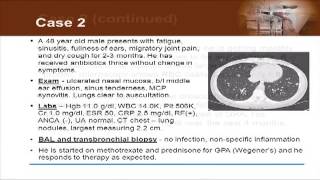 Detecting Vasculitis Before Its Too Late [upl. by Milon261]