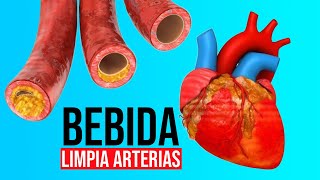 3 Ingredientes se viralizan al ser capaces de limpiar las arterias coronarias [upl. by Wendalyn381]