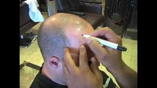 Micro Hair Pigmentation Demonstration  by Los Angeles Hair Tamir Melamed [upl. by Dhiren]