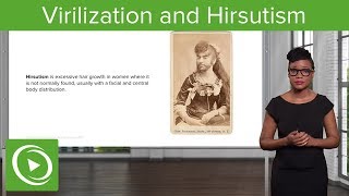 Virilization and Hirsutism – Gynecology  Lecturio [upl. by Harvey632]