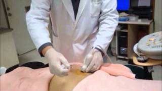 UltrasoundGuided Sacroiliac Joint Injection Technique [upl. by Eanat]