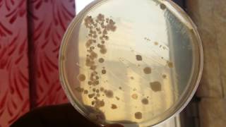 Bacillus subtilis on the nutrient agar [upl. by Koosis]