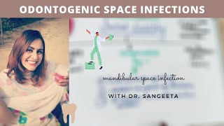 space infection in mandible I oral surgery lecture [upl. by Couhp653]