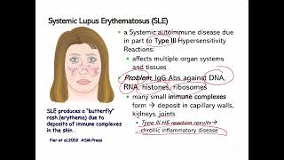 Lecture 20 Autoimmunity and Hypersensitivity Reactions [upl. by Barling81]