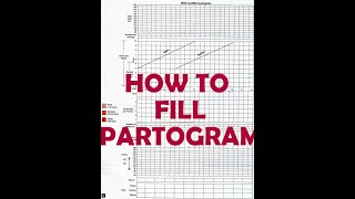 HOW TO FILL PARTOGRAM  VERY EASY [upl. by Cirone]