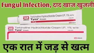 Tyza Cream Uses  Terbinafine Cream  दाद खाज खुजली Fungul Infection जड़ से ठीक करे [upl. by Dunc]