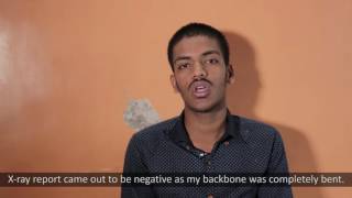 Adalimumab  Ankylosing Spondylitis  Testimonial  Mumbai [upl. by Eimaral]