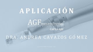 APLICACIÓN  Dra Andrea CavazosGómez  AGF Capillary  Medicina Regenerativa Capilar [upl. by Anazraf]