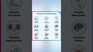 Complications of diabetes mellitus [upl. by Trebornhoj]