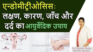 Endometriosis Symptoms causes Pain relief Diagnosis and Ayurvedic Treatment  Aasha Ayurveda [upl. by Freyah]