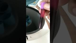 Centrifuge machine plasma separation of blood [upl. by Lokin883]