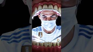 Ronaldo the dentist🦷🪥 [upl. by Notlem]