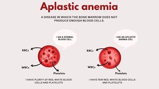 Aplastic Anaemia  Characteristics Causes Symptoms Diagnosis and Treatment [upl. by Efar529]