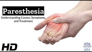 Paresthesia The Shocking Sensation You Need to Know About [upl. by Saalocin552]