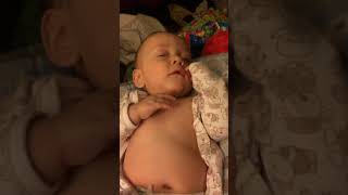 Example of Retractions Belly Breathing and Tachypnea in Infant [upl. by Itnava]