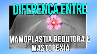 DIFERENÇA ENTRE MAMOPLASTIA REDUTORA E MASTOPEXIA  CIRURGIA PLÁSTICA [upl. by Nyvar601]