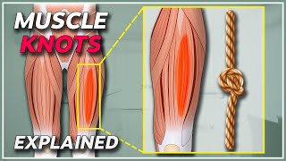 What is a muscle knot  Muscle knots amp trigger points explained [upl. by Narine]