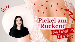 Rücken Akne So wirst du Pickel am Rücken schnell los [upl. by Dahcir]