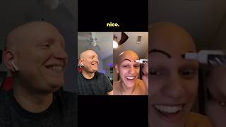 I GET EYEBROWS comedy funny lol alopecia bald mcsquared90 [upl. by Anehta]