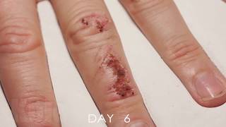 Wound Healing Time Lapse [upl. by Loftus]