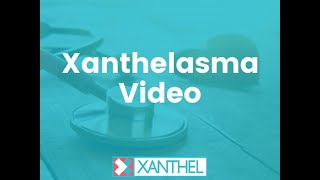 Xanthelasma How To Easily Remove Them With Xanthel ® Suprisingly Affordable [upl. by Letney]