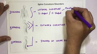 Spine Curvature Disorders  Scoliosis Kyphosis Lordosis [upl. by Suivatco765]