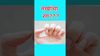 नखांचारंगhealth anaemiabloodtesthbhaemoglobinरक्तवाढीसाठीरक्त healthadvice pallornail [upl. by Asilef181]