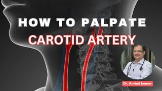 Carotid artery palpation method  Dr Arvind Kumar [upl. by Egerton]