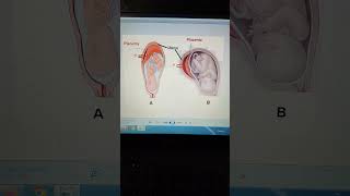 OSCE Obstetrics 8 [upl. by Kipp]