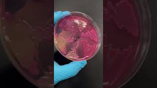 Acinetobacter baumannii is pretty 😊 [upl. by Nirrat]