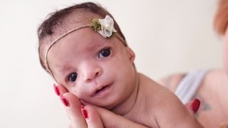 Adoptive Mom Abandons Baby In Hospital After Being Born with Rare Condition [upl. by Eceerahs]