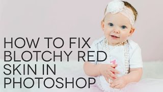 How to Fix Blotchy Red Skin in Photoshop [upl. by Sophi]