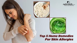 5 Best Natural Remedies For Skin Allergies [upl. by Kcirrag]