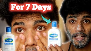 I Tested Skin Doctors Recommending Cetaphil Face Wash For 7 Days • Genuine Review • Skin Care [upl. by Griselda]