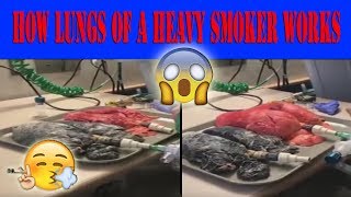 SHOCKING FOOTAGE Difference between healthy and a cancer ridden lungs of a heavy smoker [upl. by Rebmetpes]