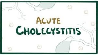 Acute cholecystitis [upl. by Taddeusz]