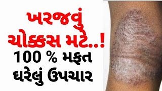 ખરજવું મટાડવા માટે  Eczema ka ilaj kharajvuDesiUpcharGujaratihelthtips GujaratiAyurvedicUpchar [upl. by Okim]