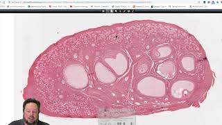 Histology 101 Twitch Live Stream  Histology of the Ovary Oogenesis amp Folliculogenesis [upl. by Hashim]