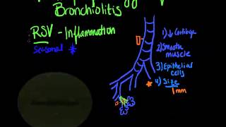 bronchiolitis pathophysiology clayton and berro [upl. by Haerb]