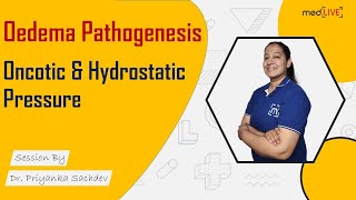 Oedema Pathogenesis  Oncotic amp Hydrostatic Pressure  Pathology  MedLive by Dr Priyanka Sachdev [upl. by Aja212]