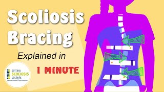 Scoliosis Brace  Explained Under 1 Minute [upl. by Annekim]