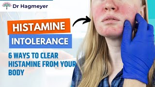 How to Clear Histamine How To Get Rid of Histamine in 6 Easy Steps💪 Dr Richard Hagmeyer [upl. by Nizam]