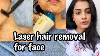 LASER HAIR REMOVAL FACE  My Experience of Facial Laser Hair Removal  Laser Hair Removal in India [upl. by Linc419]