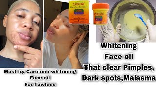 Use Carotone without side effects  How to Mix Carotone to whitening face oil for whiten dark spots [upl. by Ameg]