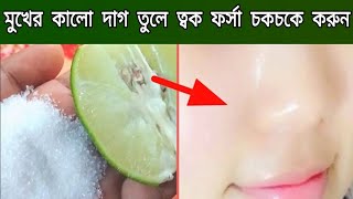 ২ মিনিটে মুখের কালো দাগ দূর করার উপায়লেবু চিনির সাথে মাত্র ১টি উপকরণ মিশিয়ে ত্বক ধবধবে ফর্সা করুন [upl. by Lucie162]