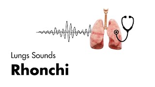 Rhonchi  Lung Sounds  Medzcool [upl. by Kopaz381]