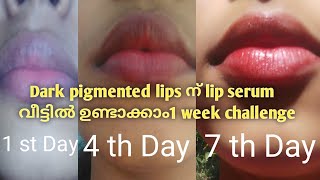 Lip serum for dark pigmented lips  1 Week challenge  Home Remedy [upl. by Strephon]