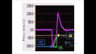 APRV Setting TLow based on the expiratory flow waveform [upl. by Kutzenco]