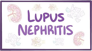 Lupus nephritis  causes symptoms diagnosis treatment pathology [upl. by Eniledam685]